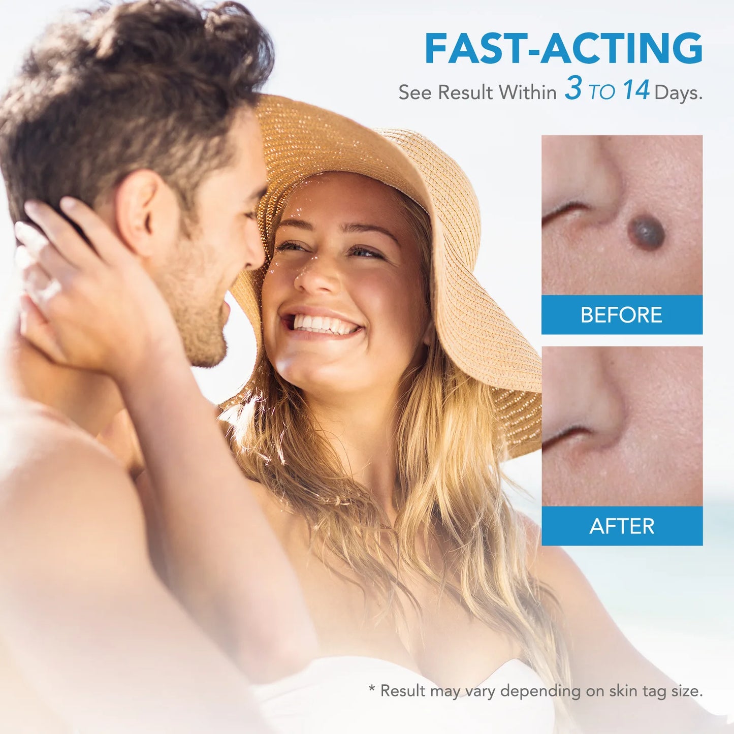 Skin Tag Remover Kit