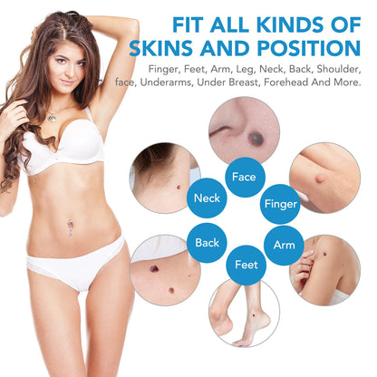 Skin Tag Remover Kit